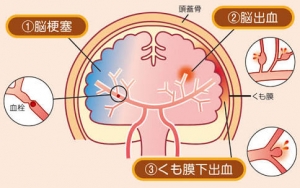 images (1)