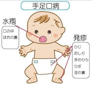 images (1)