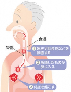 images (3)