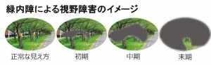 images (4)